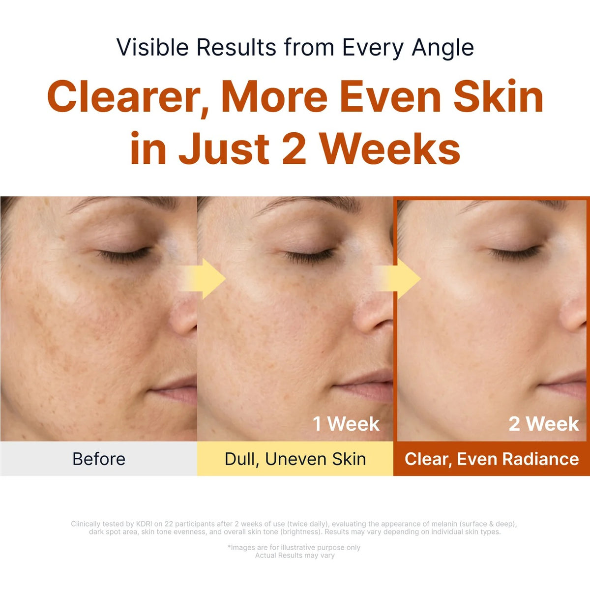 Sungboon Editor - Kojic Acid Niacinamide Brightening Ampoule - 40ml - Image 3