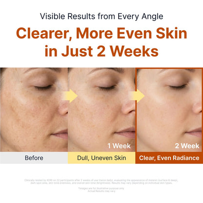 Sungboon Editor - Kojic Acid Niacinamide Brightening Ampoule - 40ml - Image 3