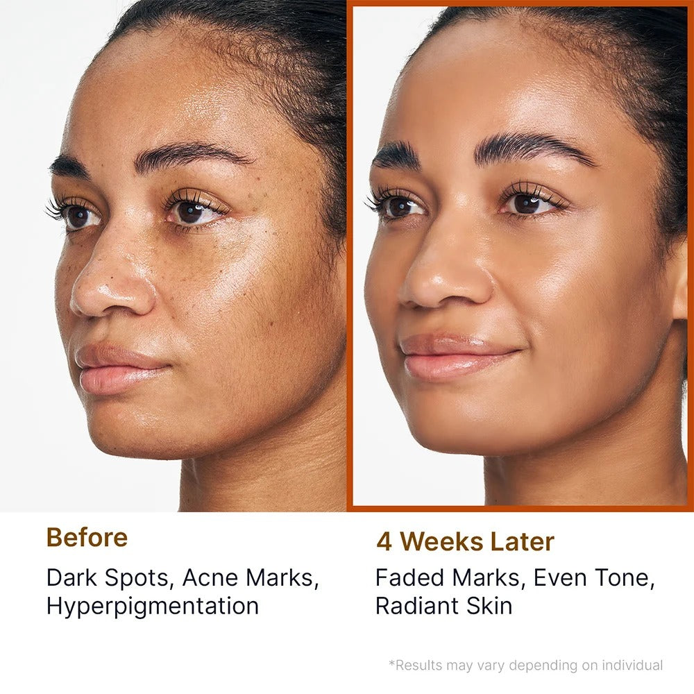 Sungboon Editor - Kojic Acid Niacinamide Brightening Face Gel Cleanser - 120g - Image 5