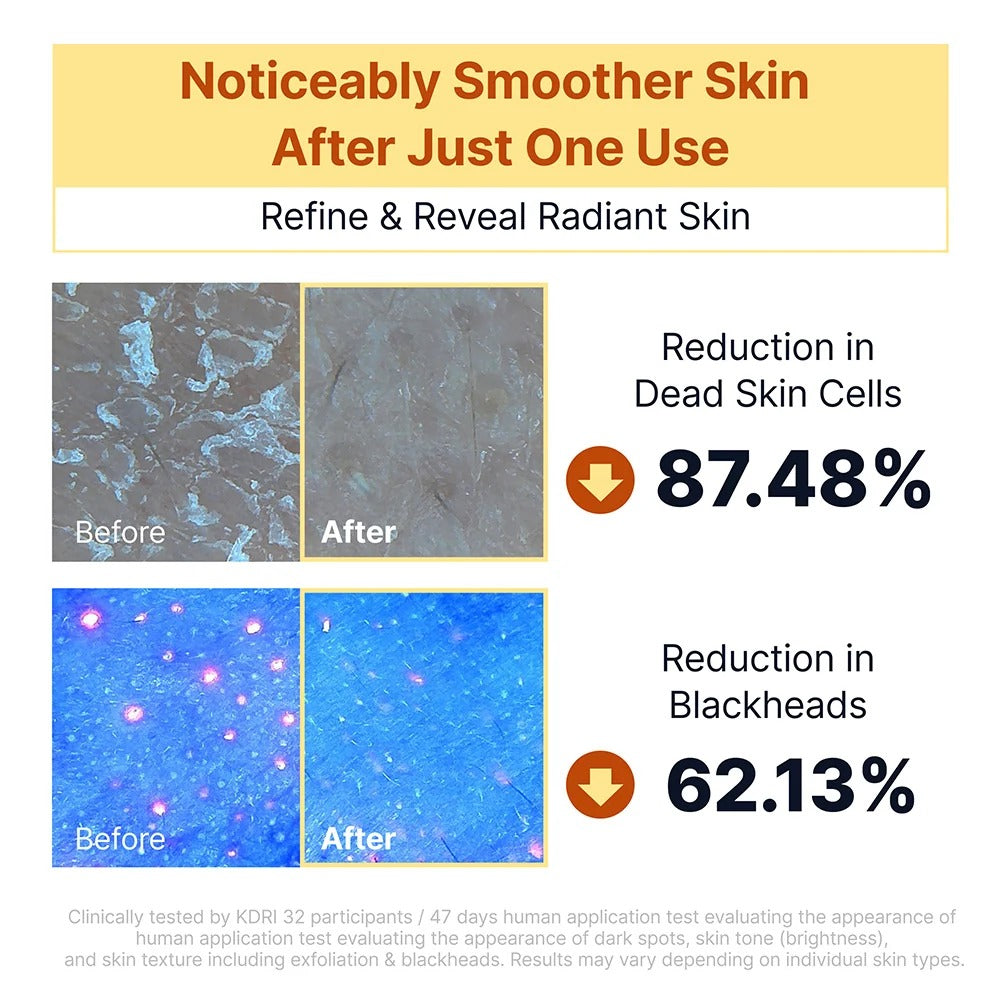 Sungboon Editor - Kojic Acid Niacinamide Brightening Rice Peel Shot - 80ml - Image 3