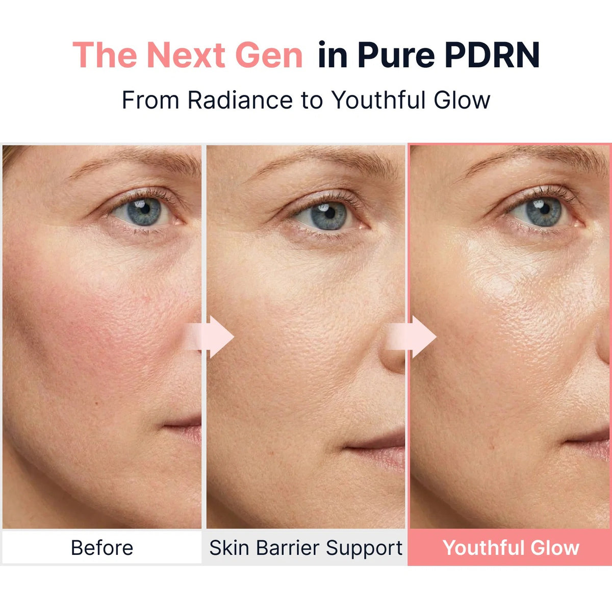 Sungboon Editor - Collagen Peptide Pink PDRN Glow Intensive Ampoule - 40ml - Image 6