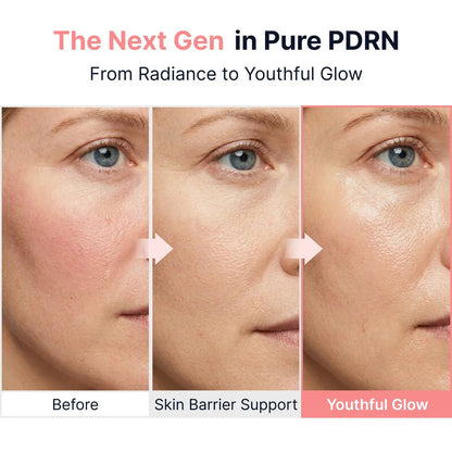 Sungboon Editor - Collagen Peptide Pink PDRN Glow Intensive Ampoule - 40ml - Image 6