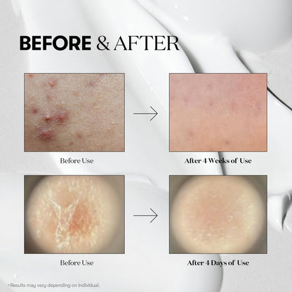 VT Cosmetics - Reedle Shot 100 - 50ml