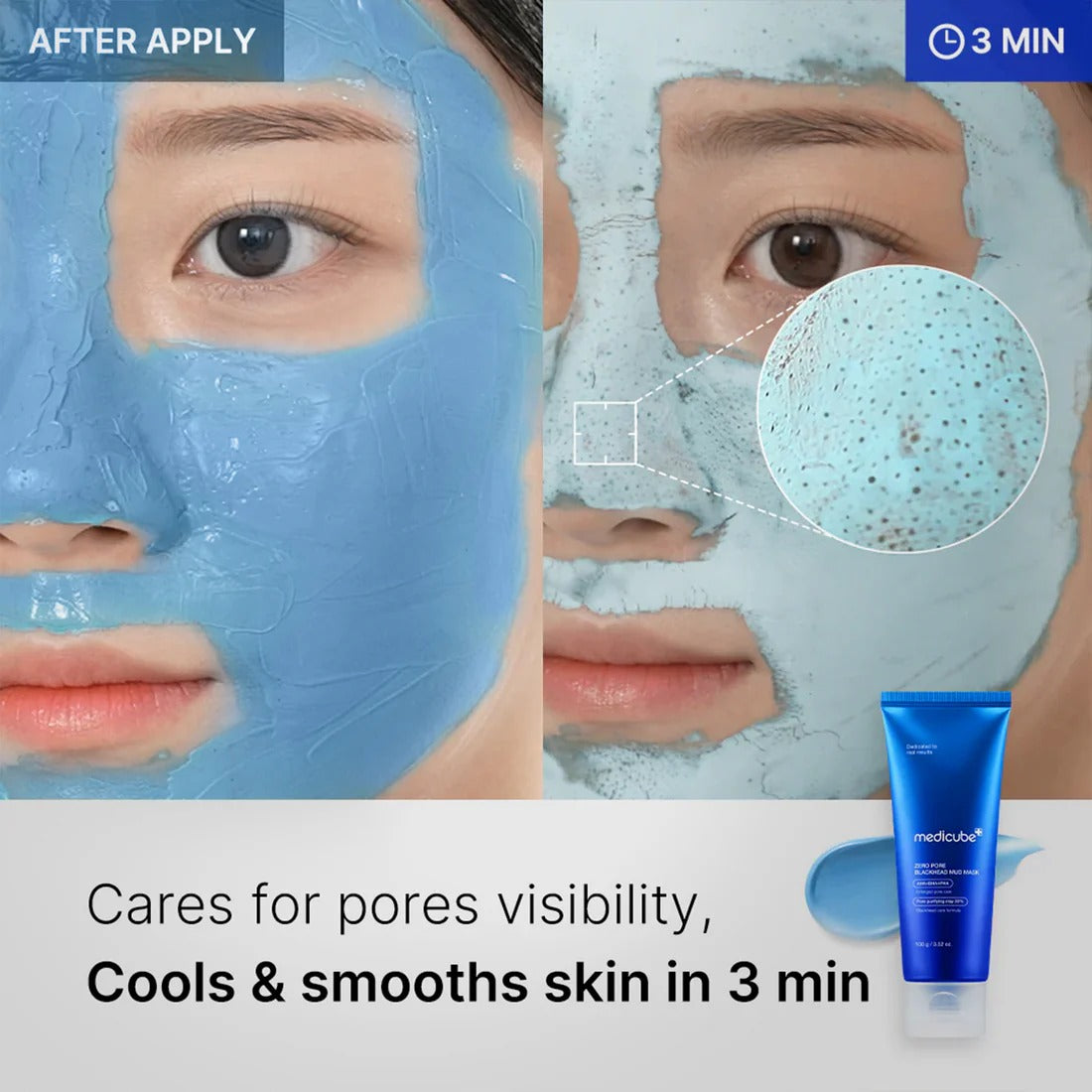 Medicube - Zero Pore Blackhead Mud Mask - 100g