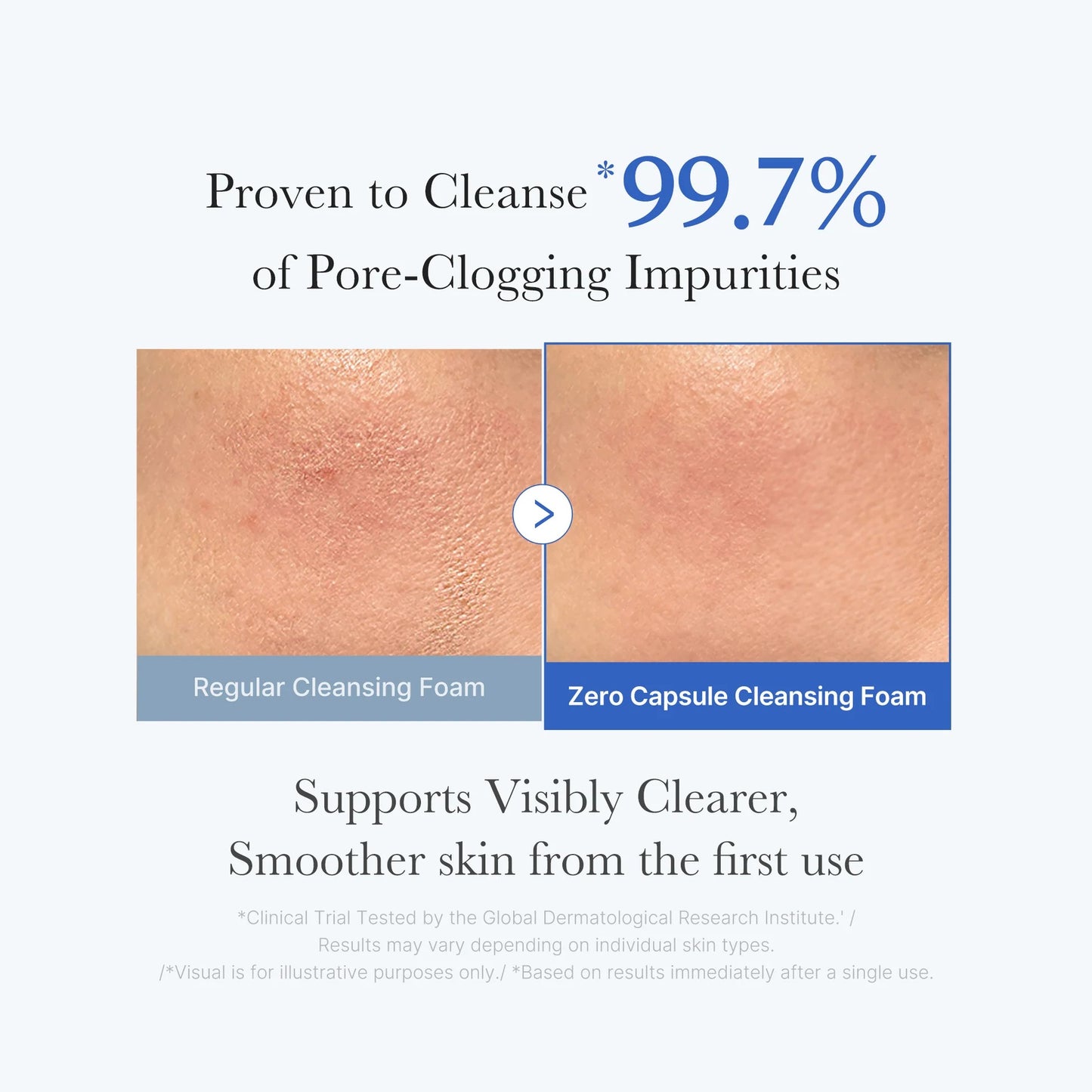 Medicube - Zero Pore Capsule Cleansing Foam - 120g