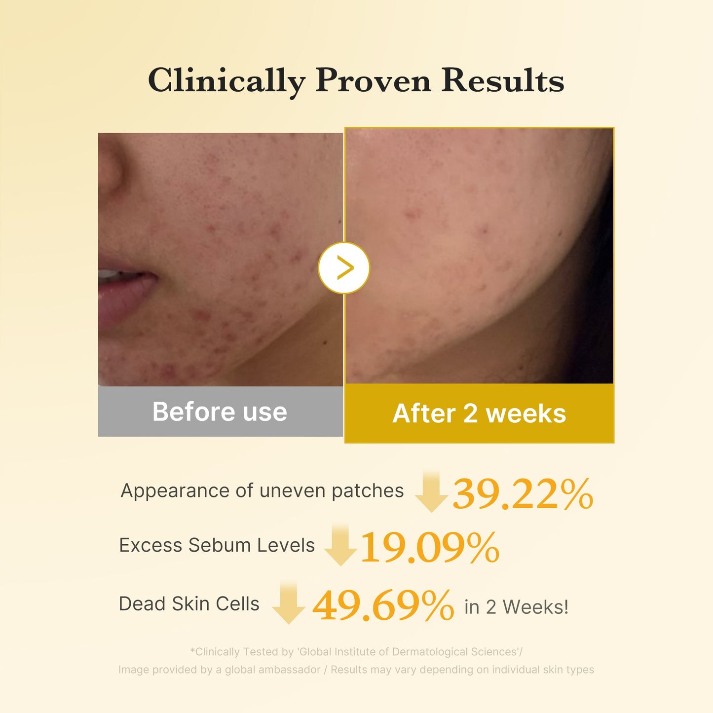 Medicube - Kojic Acid Turmeric Pad - 70 Pads