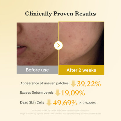 Medicube - Kojic Acid Turmeric Pad - 70 Pads