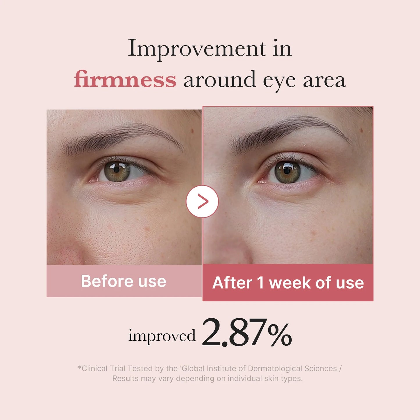 Medicube - PDRN Pink Peptide Eye Cream - 30ml
