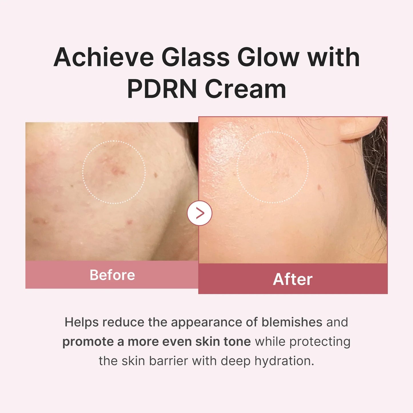Medicube - PDRN Pink Peptide Cream - 50ml