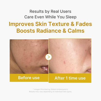 Medicube - Kojic Acid Turmeric Overnight Wrapping Mask - 75ml