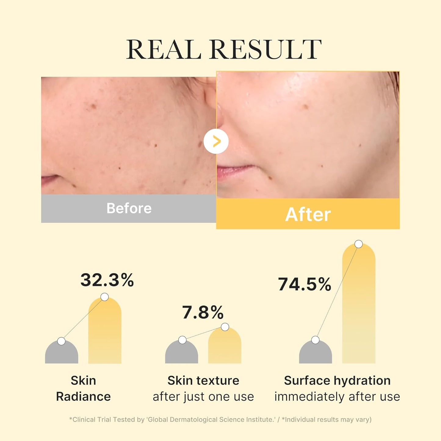 Medicube - Kojic Acid Turmeric Brightening Gel Mask Set - 4 Pack