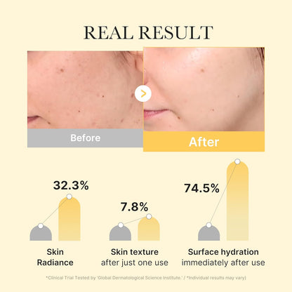 Medicube - Kojic Acid Turmeric Brightening Gel Mask Set - 4 Pack