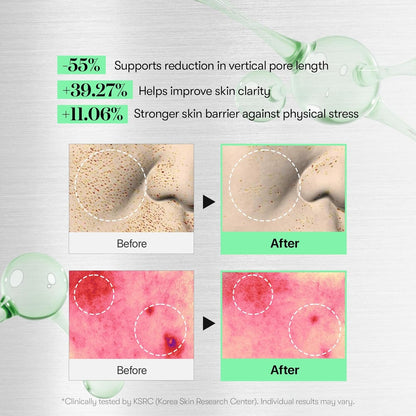 VT Cosmetics - Reedle Shot 300 - 50ml