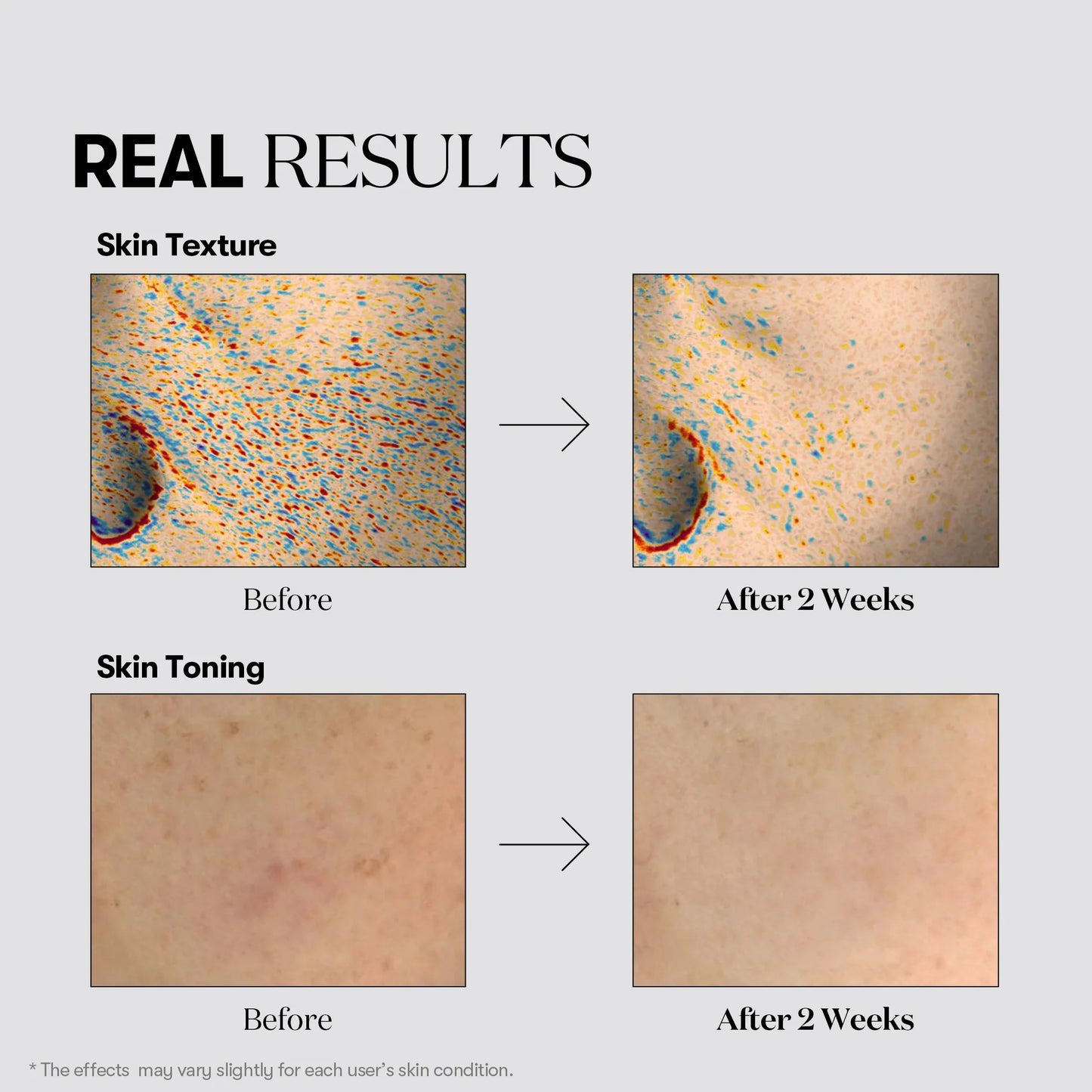 VT Cosmetics - TX-Toning Toner - 200ml