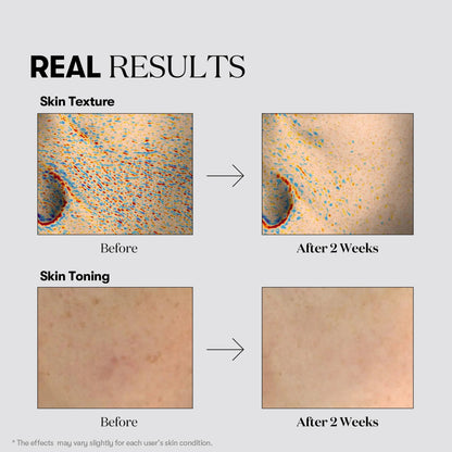 VT Cosmetics - TX-Toning Toner - 200ml