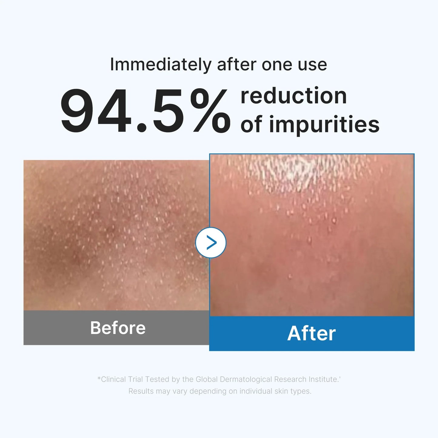 Medicube - Zero Pore Blackhead Deep Cleansing Oil - 205ml