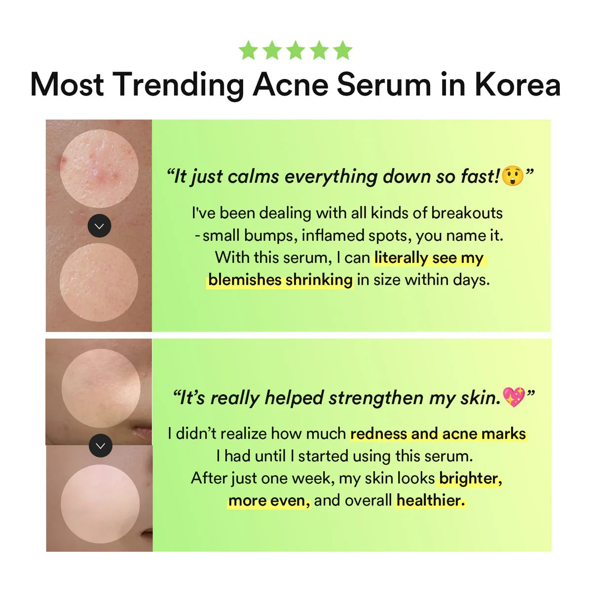 Abib - Heartleaf TECA Capsule Serum Calming Drop - 50ml