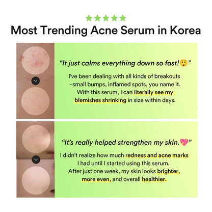 Abib - Heartleaf TECA Capsule Serum Calming Drop - 50ml