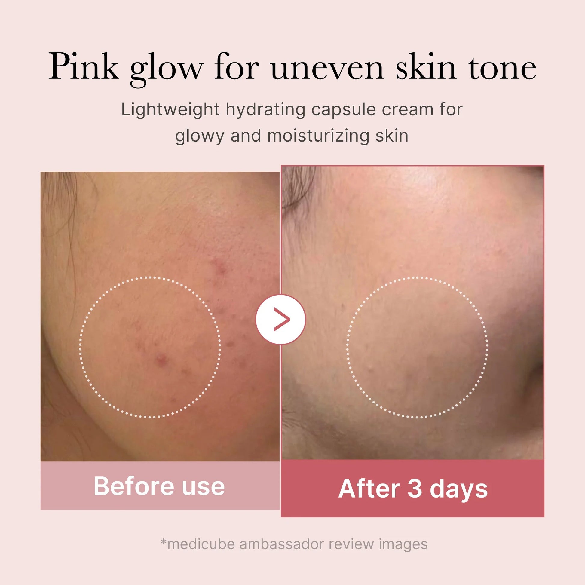 Before and after comparison of skin tone improvement with Medicube PDRN Pink Collagen Capsule Cream