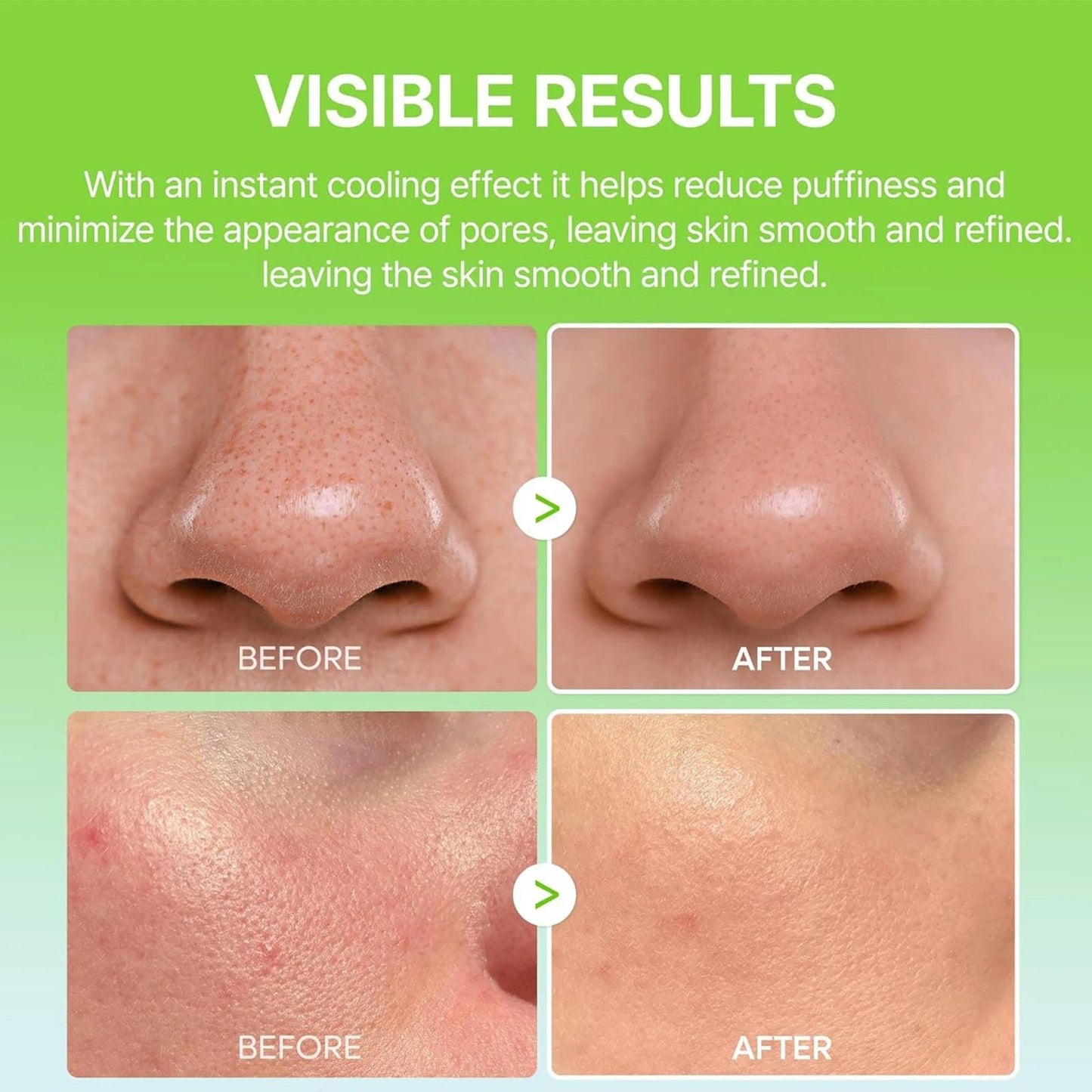 Dr. Melaxin - CACTOX Pore Relief Multi Balm - 25g